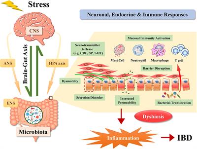 Stress Triggers Flare of Inflammatory Bowel Disease in Children and Adults